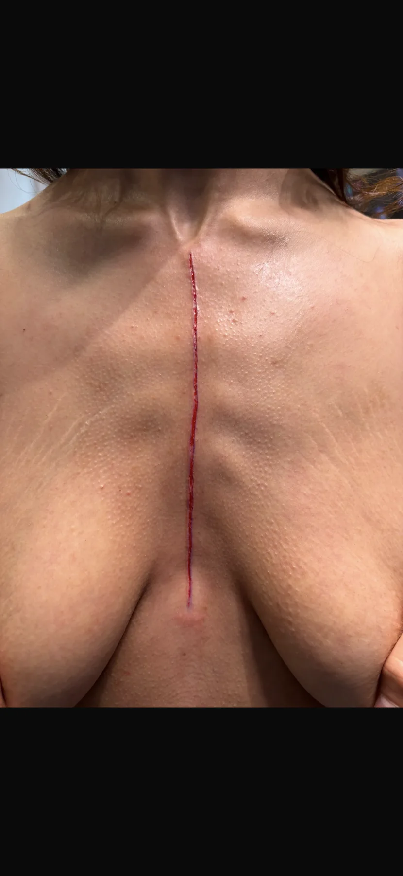 Piercing-Arbeit von Patrick bei Most Wanted Berlin – Beispiel 1