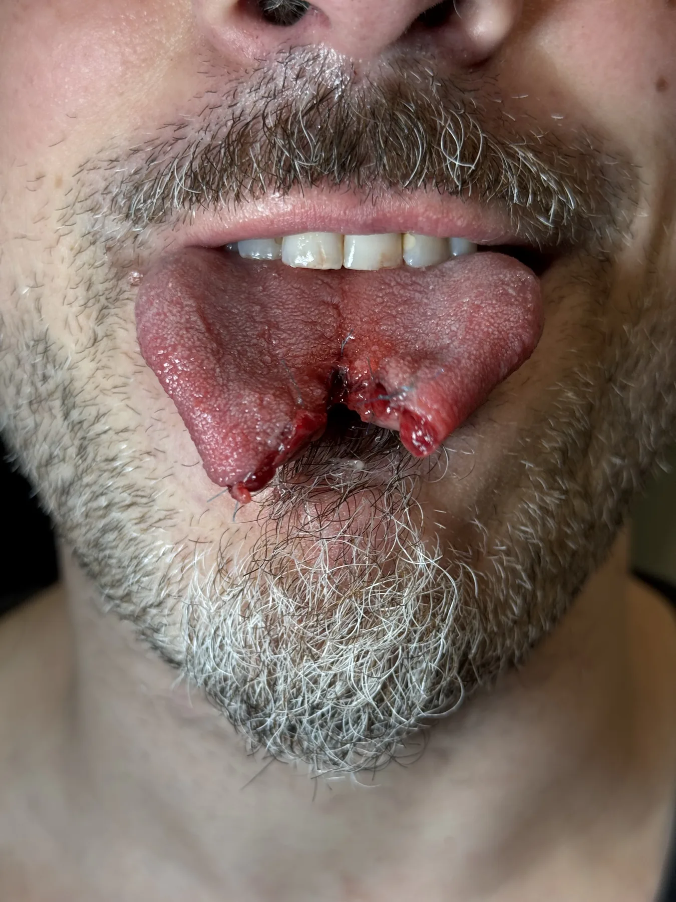 Piercing-Arbeit von Patrick bei Most Wanted Berlin – Beispiel 24
