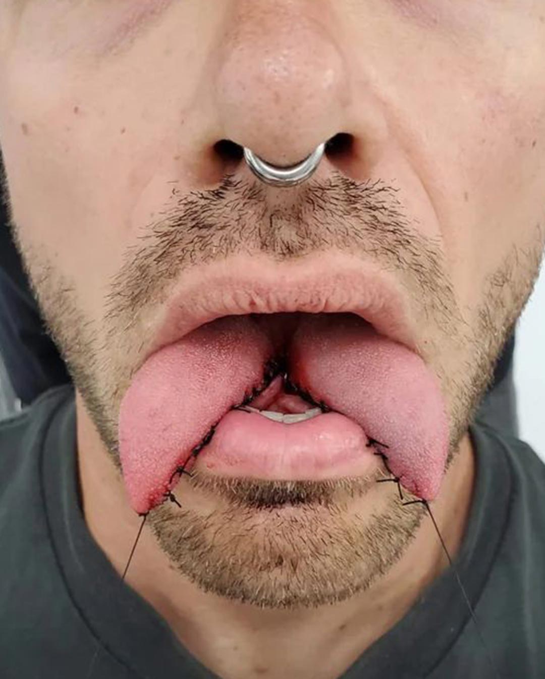 Piercing-Arbeit von Patrick bei Most Wanted Berlin – Galeriebeispiel 12